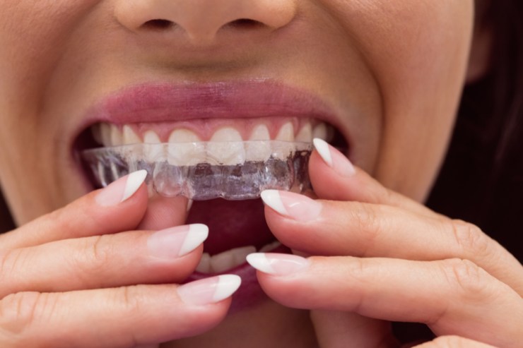 Braces