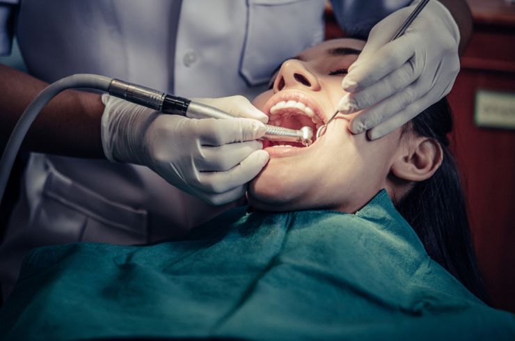 teeth Fillings